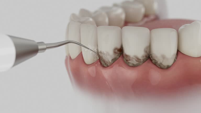 Reliable Emergency Dentist contractor in Moab, UT by Smile Center Dentistry
